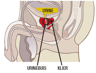 Een klier bij de urinebuis blijft je hele leven groeien wat voor een verandering in plaspatronen kan zorgen